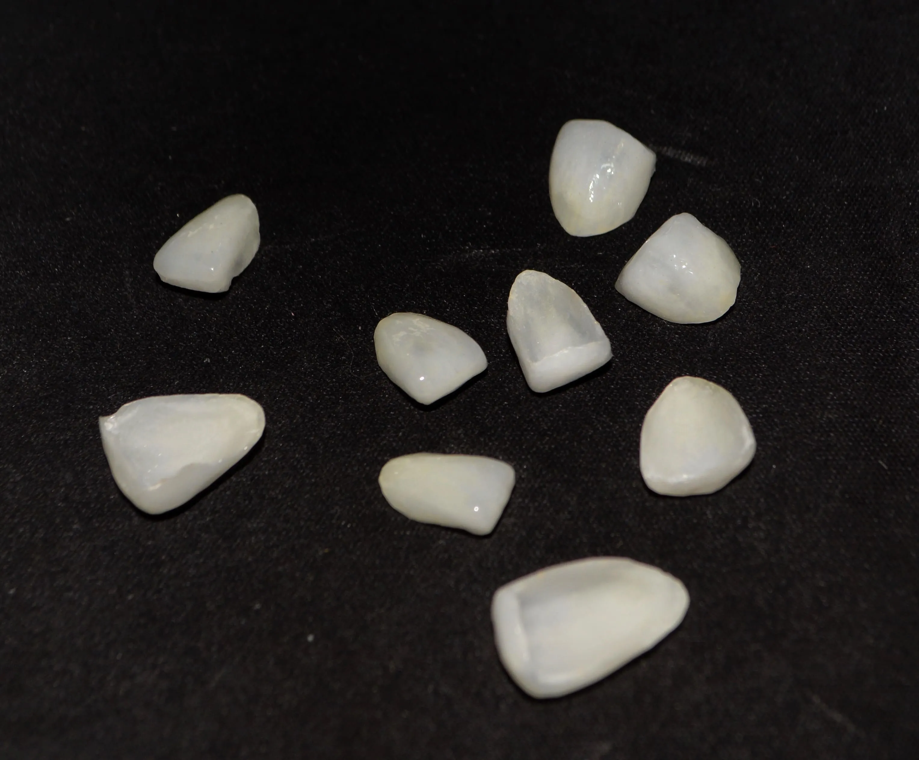 Ortodoncia vs carillas