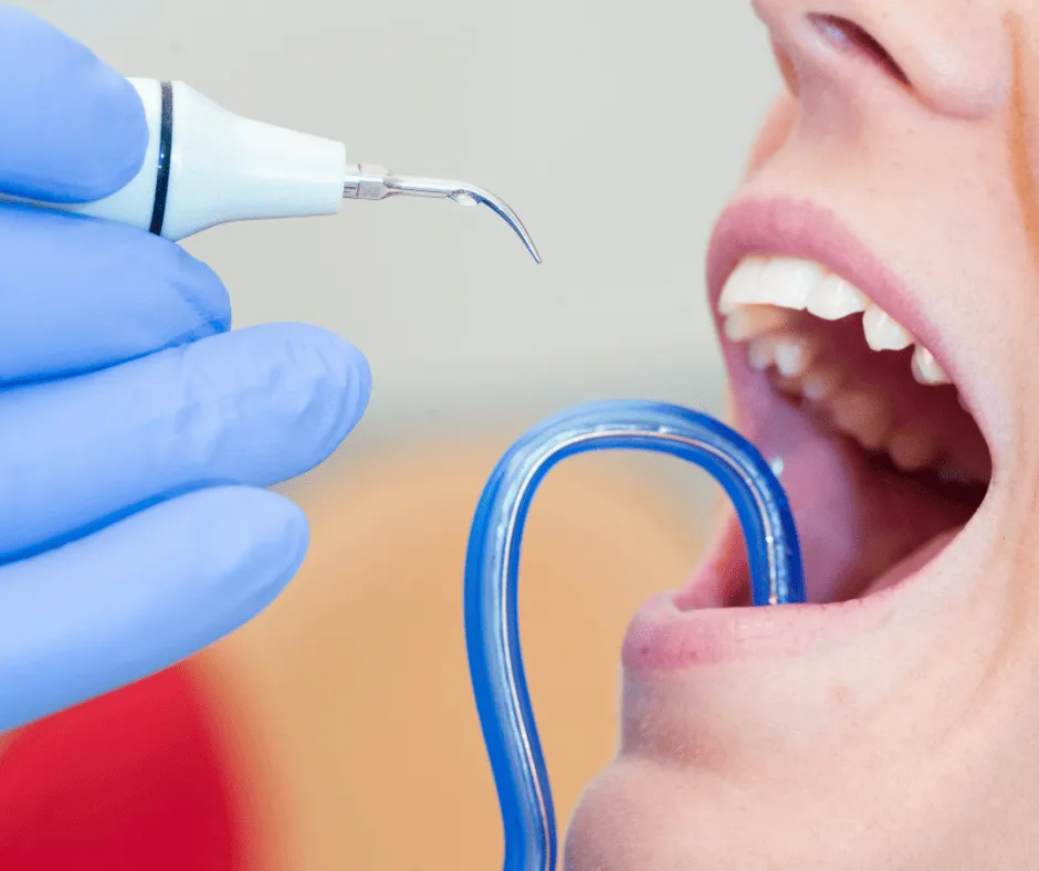 Destartraje y profilaxis