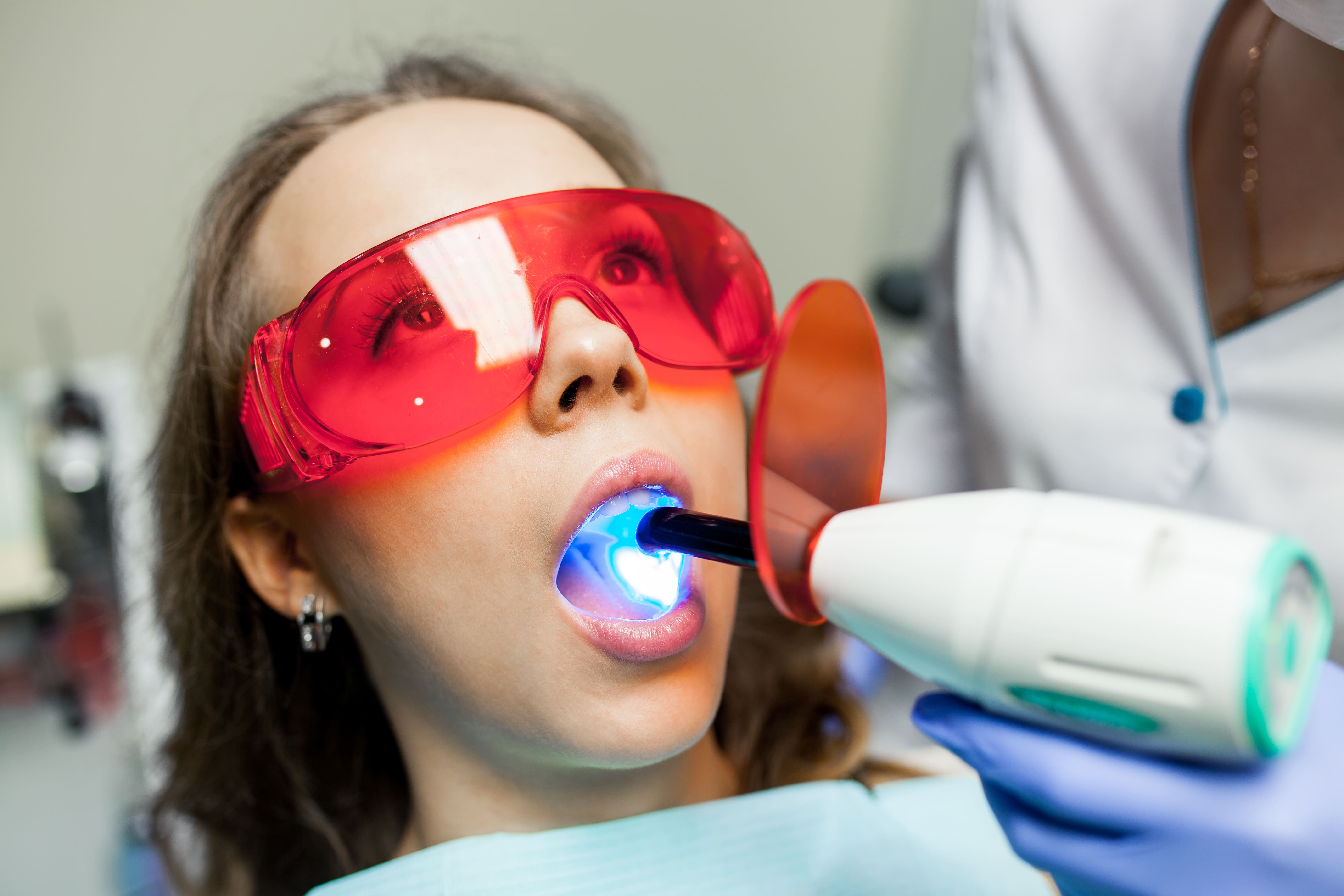Sonrisa blanca antes y después del blanqueamiento dental Lima