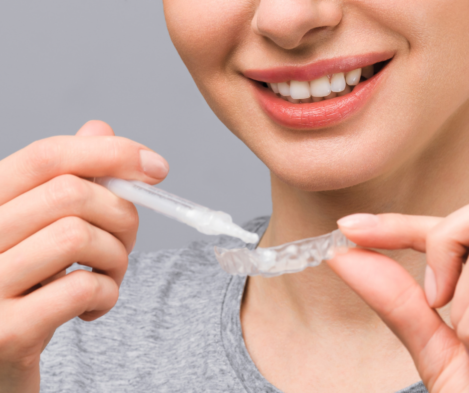 Consultorio dental en Surco - Dentistas especialistas